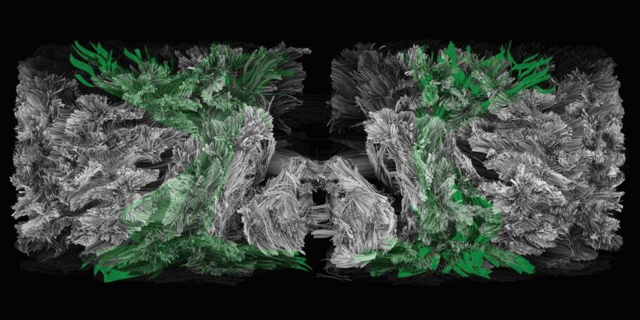 pexels-ron-lach-8102677 Brain works image. Credit: wellcome collection